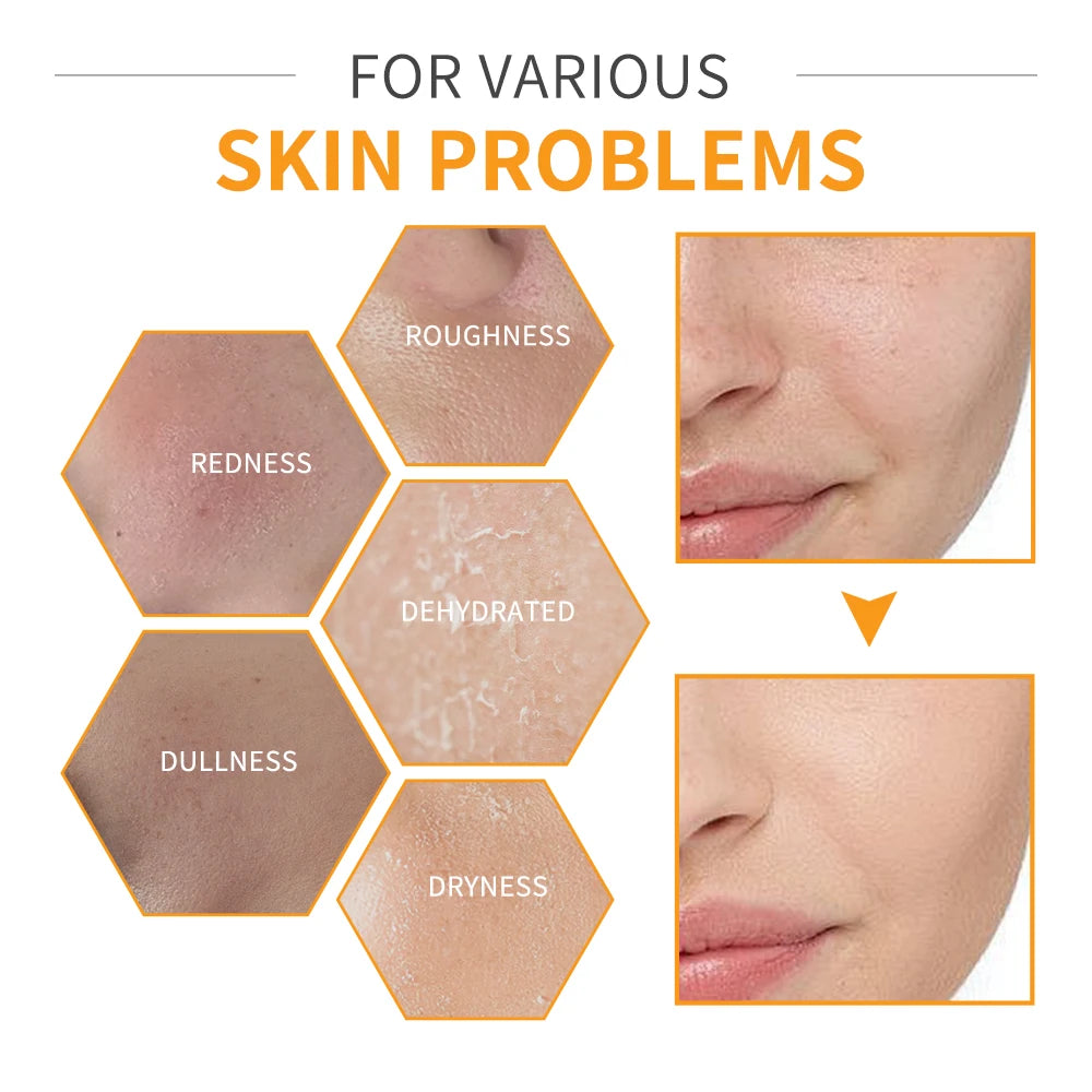Lakerain Vitamin C Skin Care Set Whitening Cream Dark Spots Serum Dark Circle Eye Facial Cleaning Moisturizing Sunscreen Kits